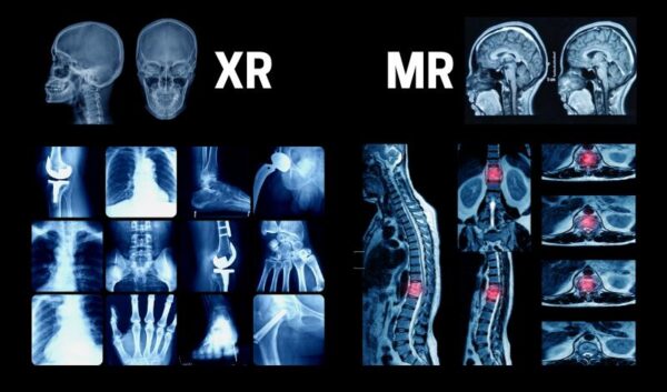 Mri Vs X Ray What S The Difference