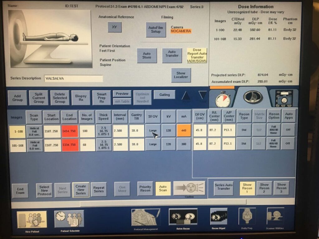 Picture of scan setup during CT tube replacement