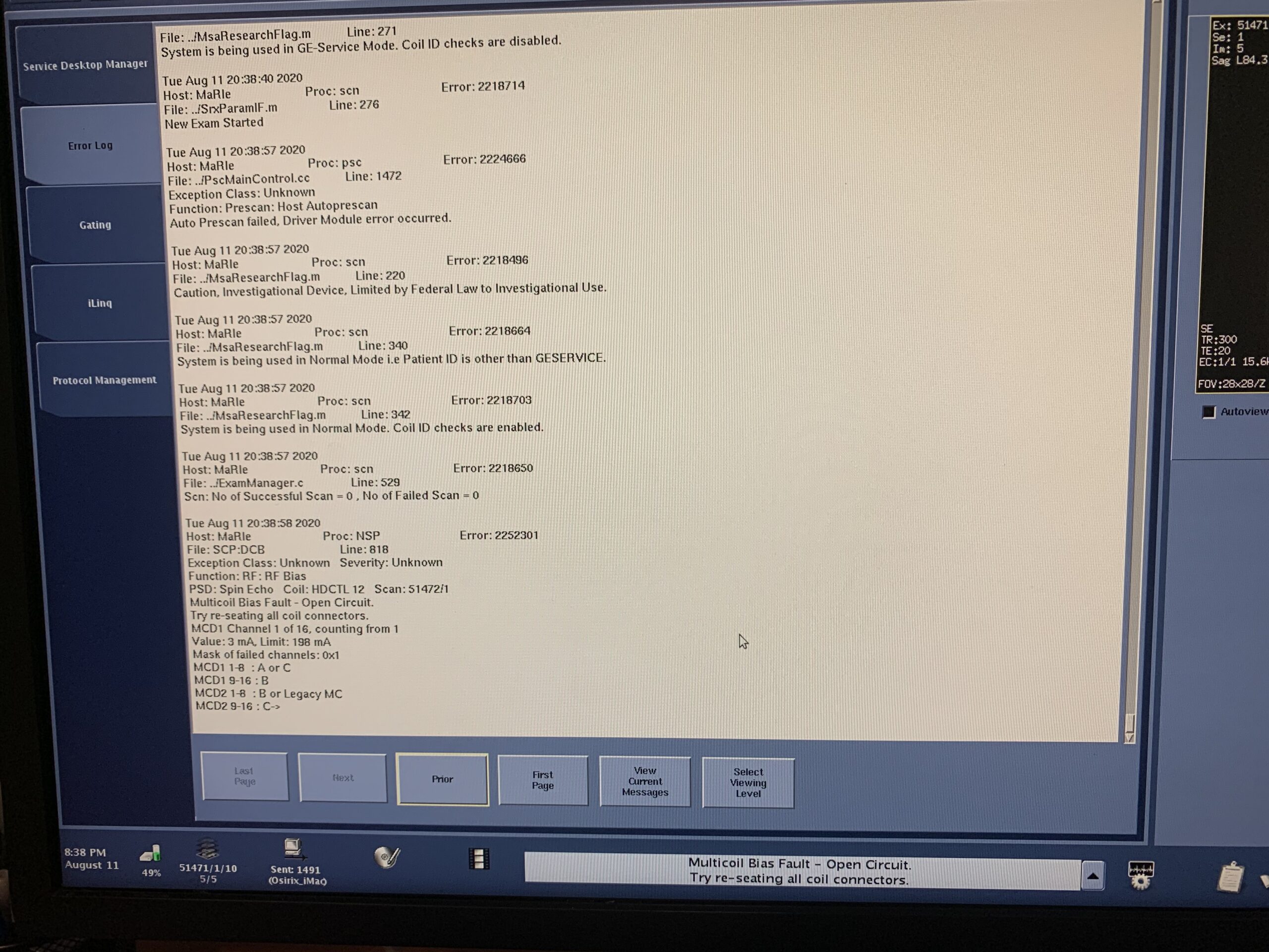 GE MRI error log, multicoil bias fault auto prescan failed