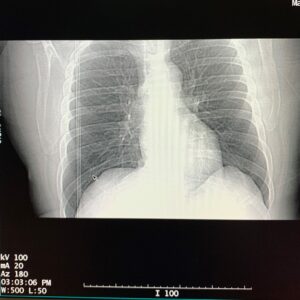 Top 5 Tips When Your CT Is Not Scanning