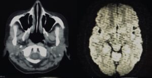 radiology software, brain mri