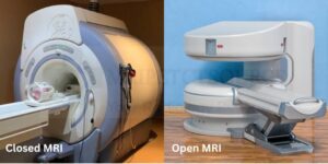 closed mri vs open mri, closed vs open mri