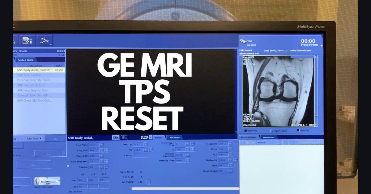 Ge Mri Tps Reset 0050