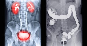 MRI Contrast Agents Clinical Applications