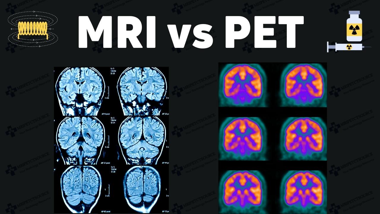 mri vs pet scan , mri vs pet scan thumbnail, magnetic resonance imagine vs positron emission tomography