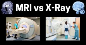 MRI vs X-Ray: What’s The Difference?