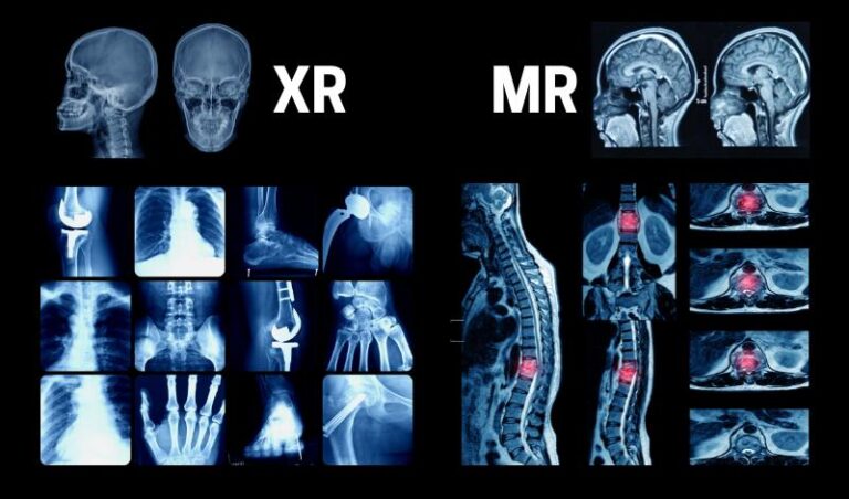 MRI vs X-Ray: What's The Difference?