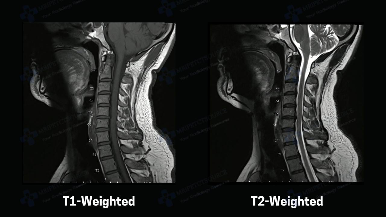 t1 vs t2 mri, what mri scan parameters affect image quality.