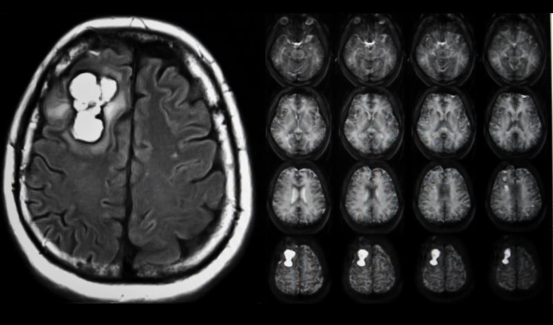 mri contrast media, mri contrast agent