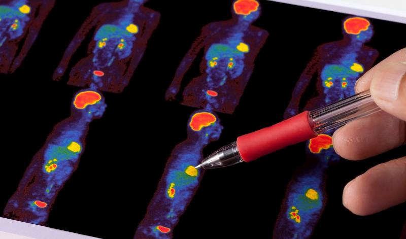 Fluorodeoxyglucose contrast, petct contrast media, pet contrast agent