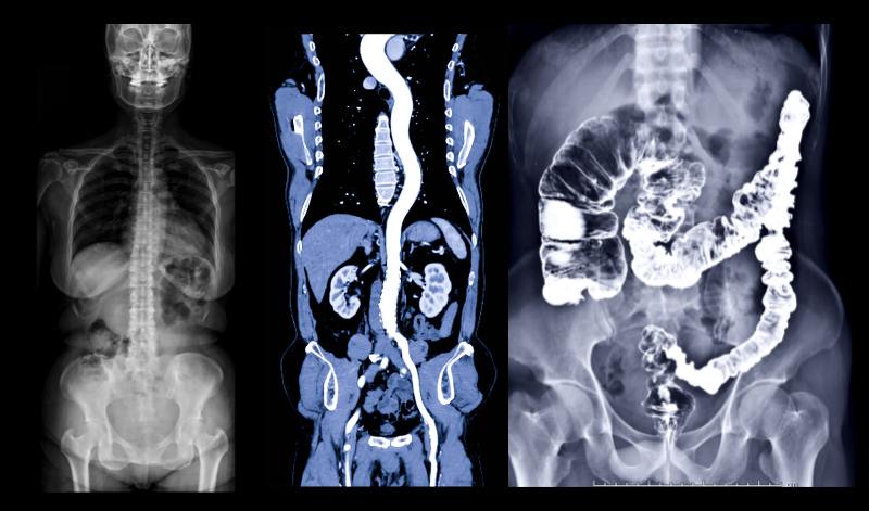 contrast media in radiology, contrast media, ct scan contrast media