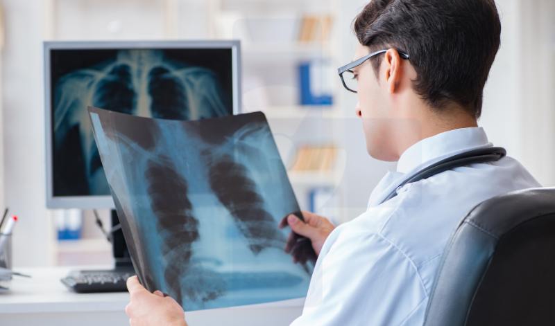 mesothelioma medical imaging