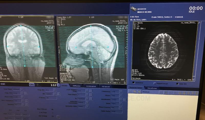 Types of MRI Explained: Which One is Right for You?